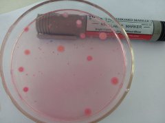 ATP熒光檢測(cè)器識(shí)別細(xì)菌的優(yōu)缺點(diǎn)